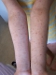 forearms%20(before)%20thumbnail.jpg